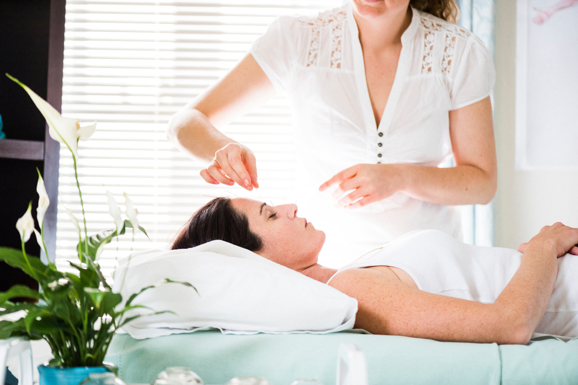 Woman having acupuncture treatment